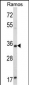 ACY3 Antibody (Center)
